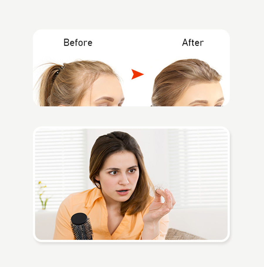 Enhanced Hair Regrowth Laser Cap