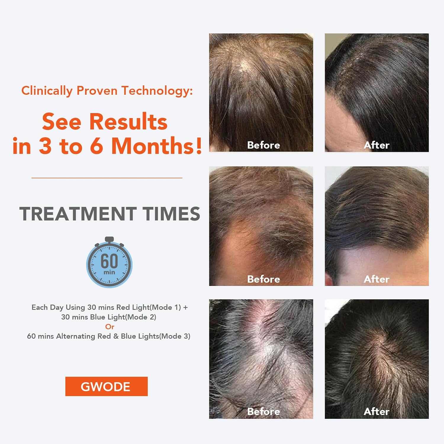 Enhanced Hair Regrowth Laser Cap
