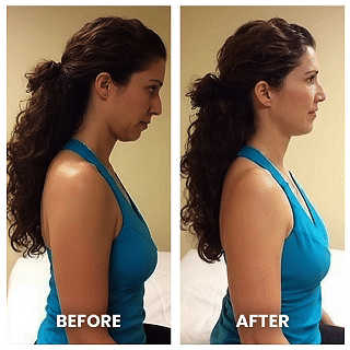 CerviCalm™ Therapeutic Neck Massager for Deep Tissue Pain Relief
